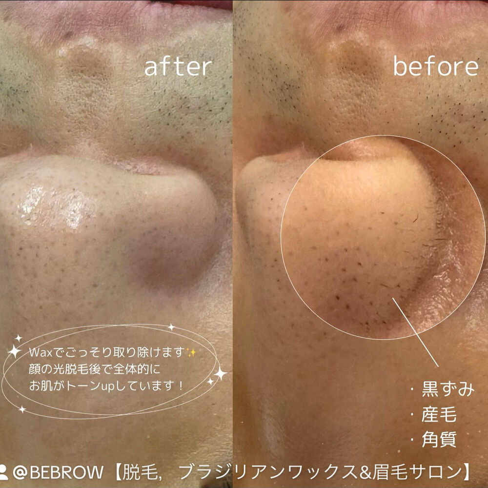 ブログ