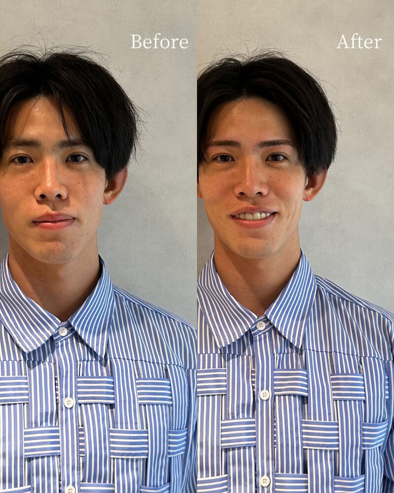 ブログ